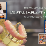 Insurance Coverage for Dental Implant Surgery: What You Need to Know