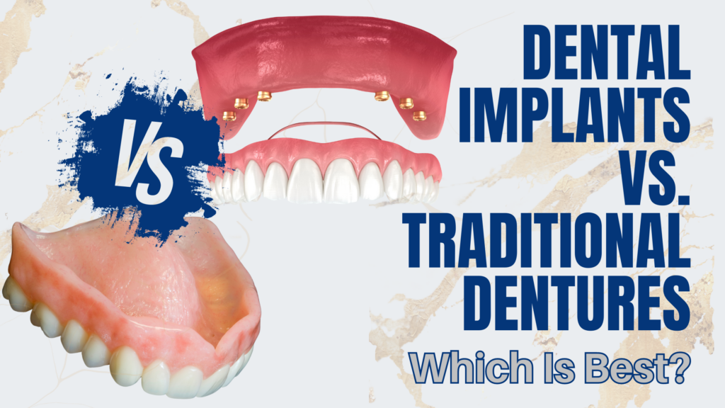 Dental Implants vs Traditional Dentures