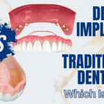 Dental Implants vs. Traditional Dentures: Which Is Best?