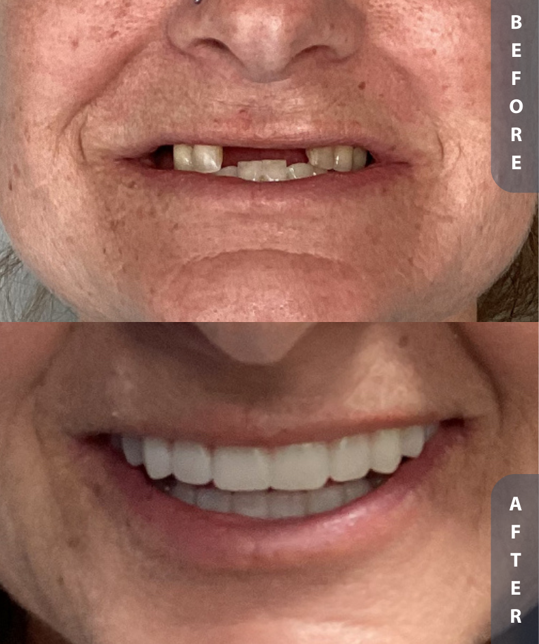 Smile Gallery Smile Gallery