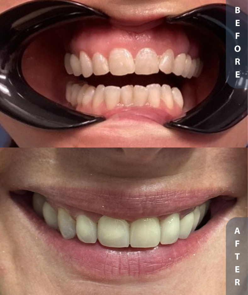 Smile Gallery Smile Gallery