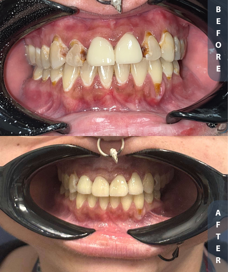 Smile Gallery Smile Gallery