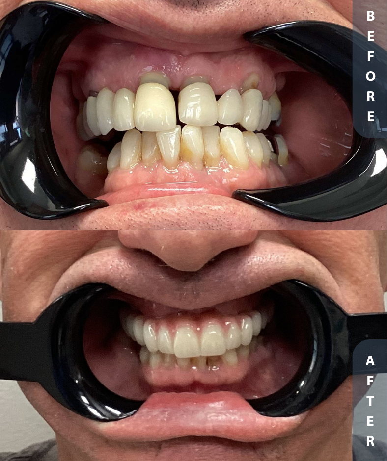 Smile Gallery Smile Gallery