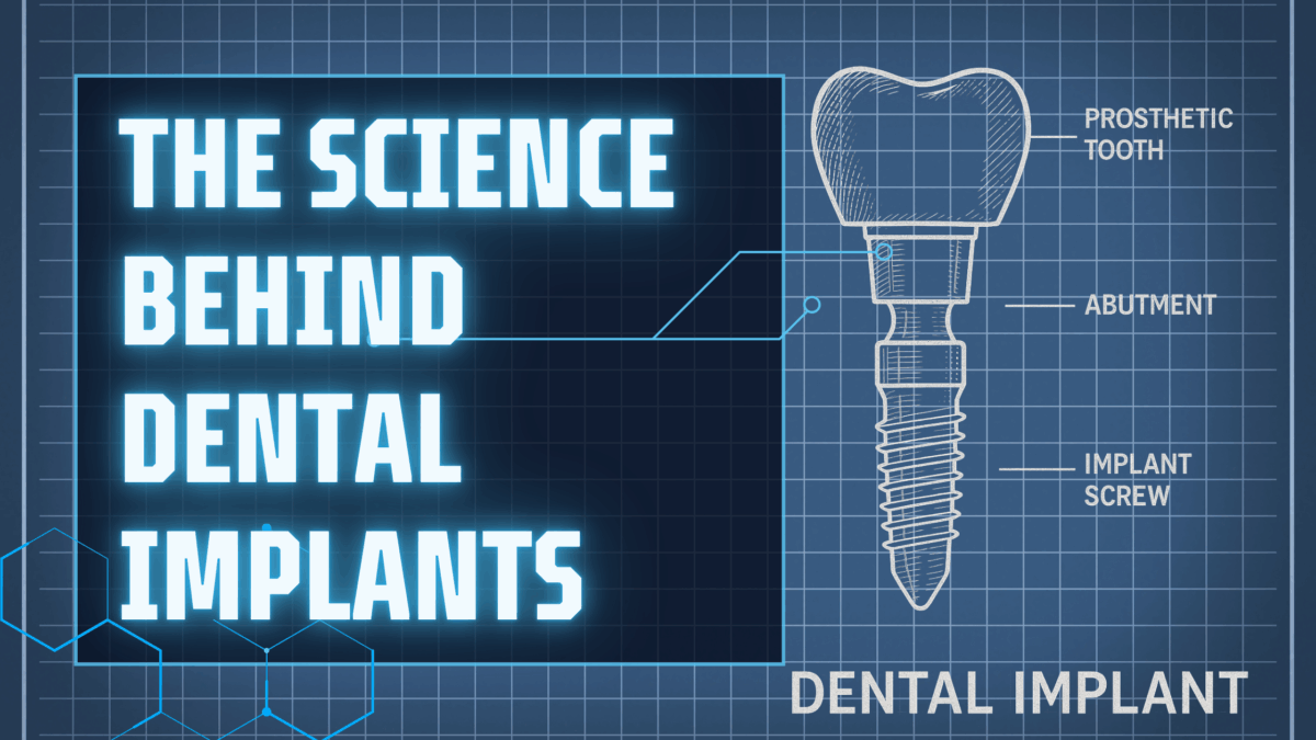 The Science Behind Dental Implants: How They Work and Why They Last