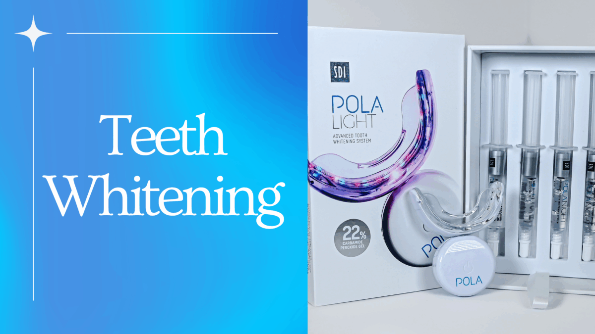 What Is Professional Teeth Whitening?